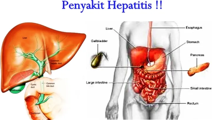 Obat Herbal Untuk Hati Penyakit Kuning Liver Special Mengobati Masalah Hati Lazada Indonesia