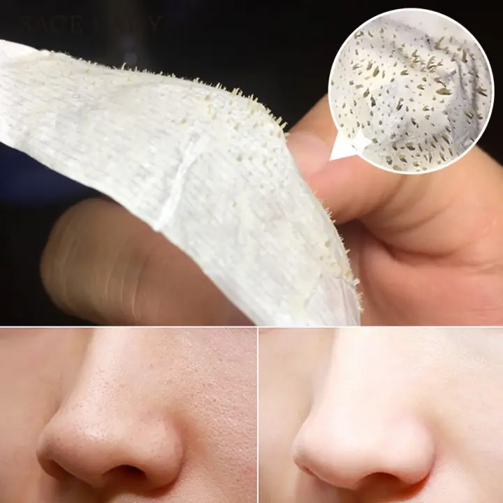 5 Masker Dari Bahan Alami Untuk Menghilangkan Komedo Soco By Sociolla