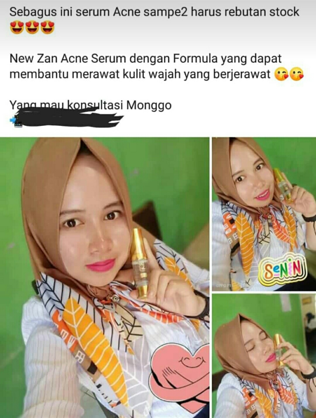 New Zan Serum Acne Jerawat Wajah Berjerawat Dan Kulit Sangat Sensitif Lazada Indonesia