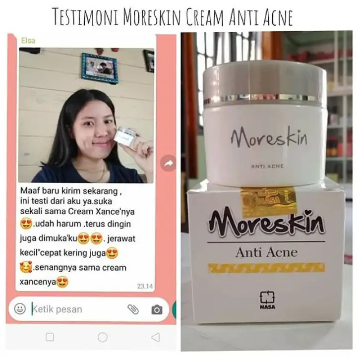 cream moreskin anti acne