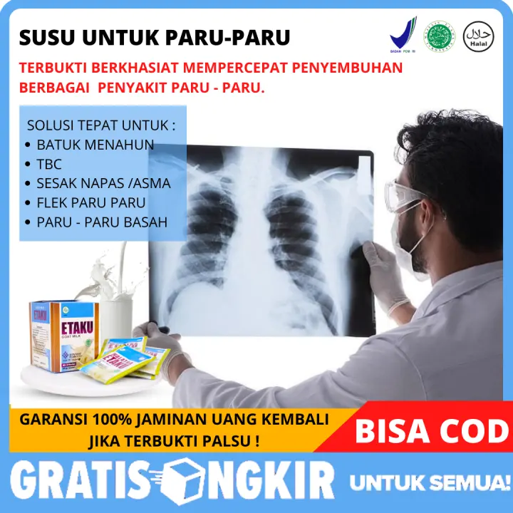 Susu Kambing Etawa Obat Tbc Batuk Berdarah Flek Paru Paru Susu Untuk Paru Paru Batuk Kering