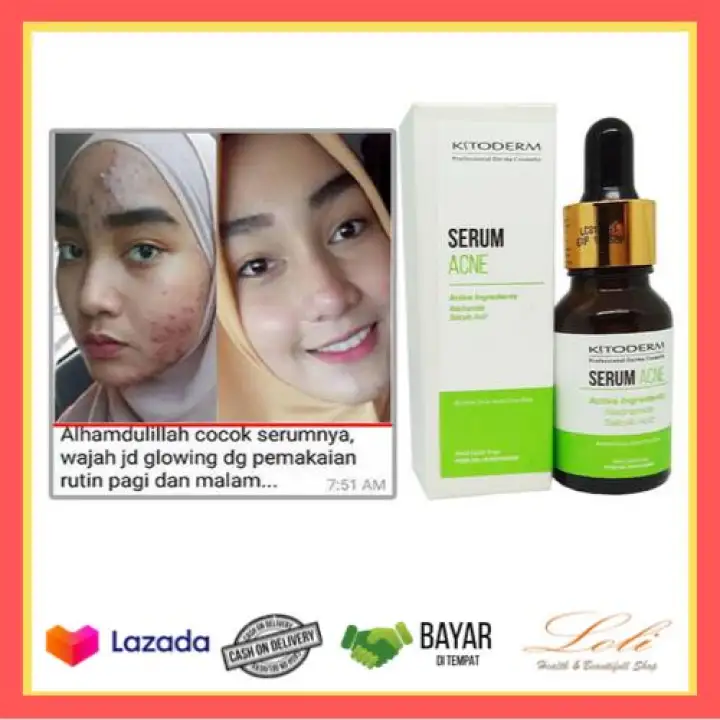 serum acne kitoderm