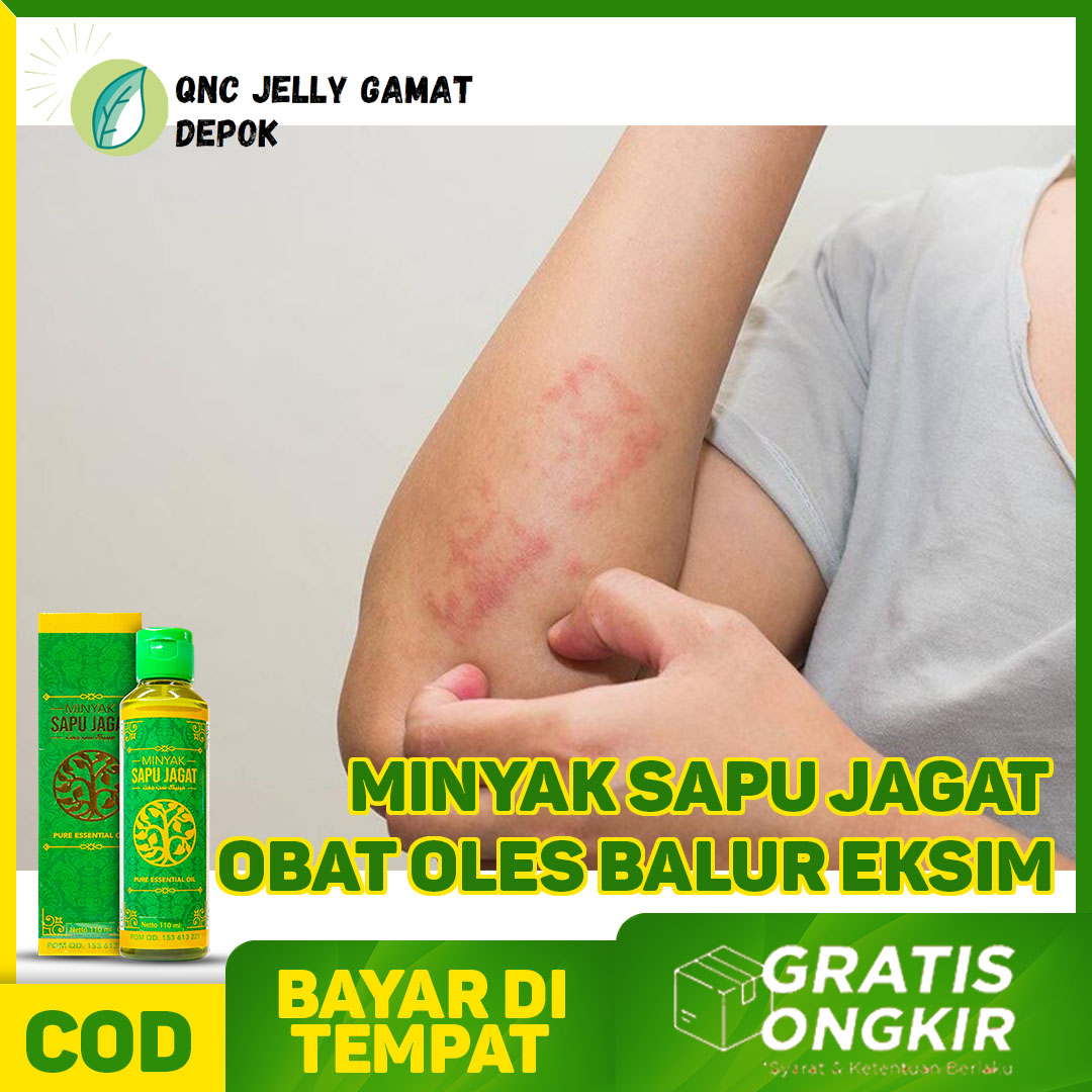 Obat Balur Eksim Minyak Oles Untuk Gatal Gatal Kulit Obat Jamur Kulit Obat Eksim Kering Minyak Balur Eksim Pada Anak Gatal Kulit Eksim Basah Minyak Gosok