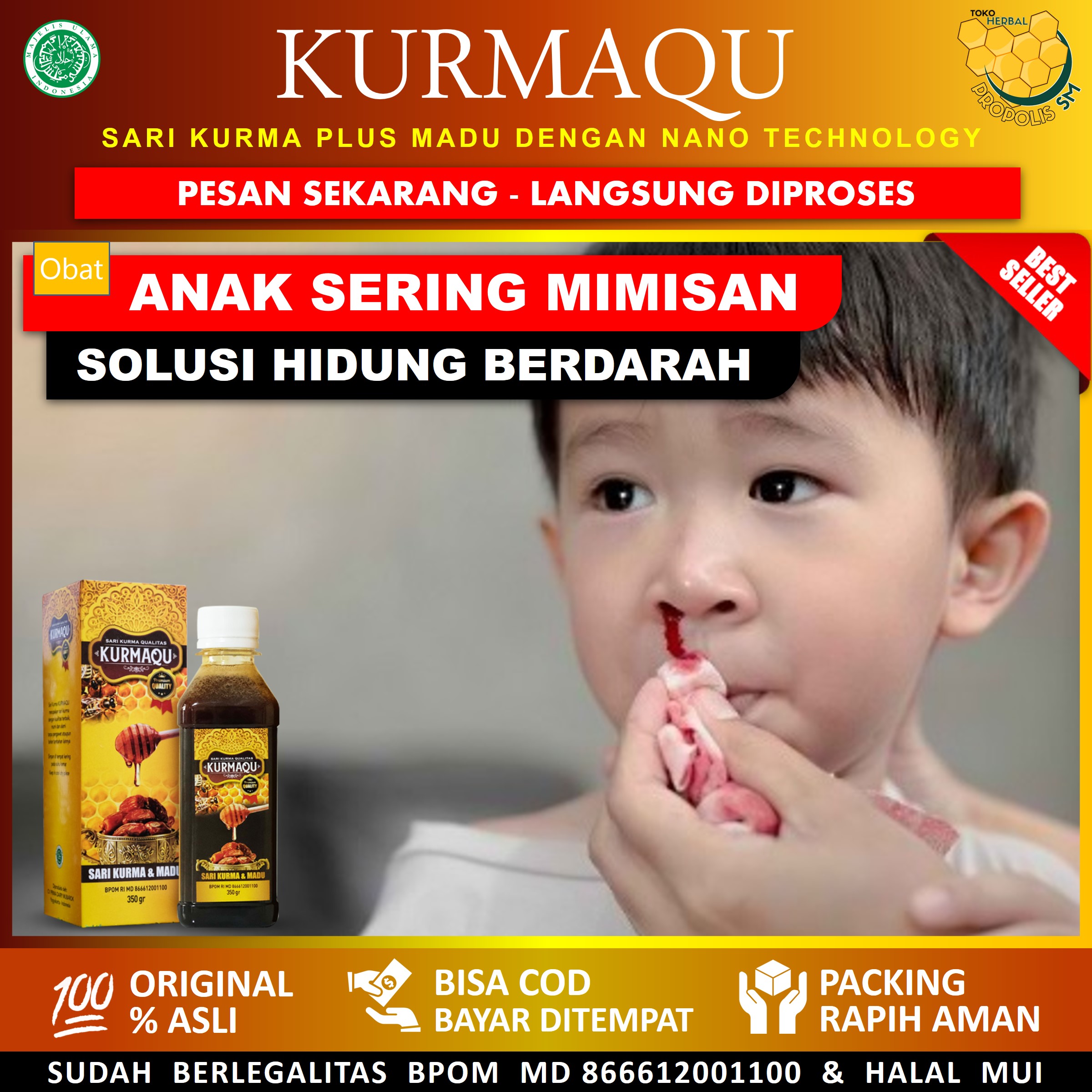 Obat Anak Sering Mimisan, Obat Hidung Mimisan Anak Dan Dewasa, Obat