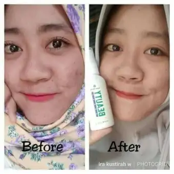 Asli Natura Beauty Spray Glutathione Collagen Whitening Original Natura World Lazada Indonesia 1 pure beauty collagen powder & 1 luxcent luminous caps l glutathione 🇬🇧🇵🇭. asli natura beauty spray glutathione collagen whitening original natura world