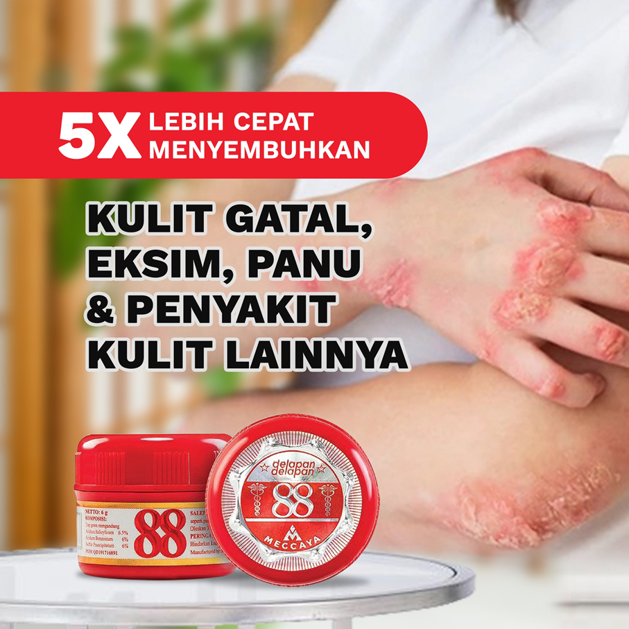 SALEP 88 6g | Salep Gatal Jamur & Scabies | MECCAYA | Lazada Indonesia