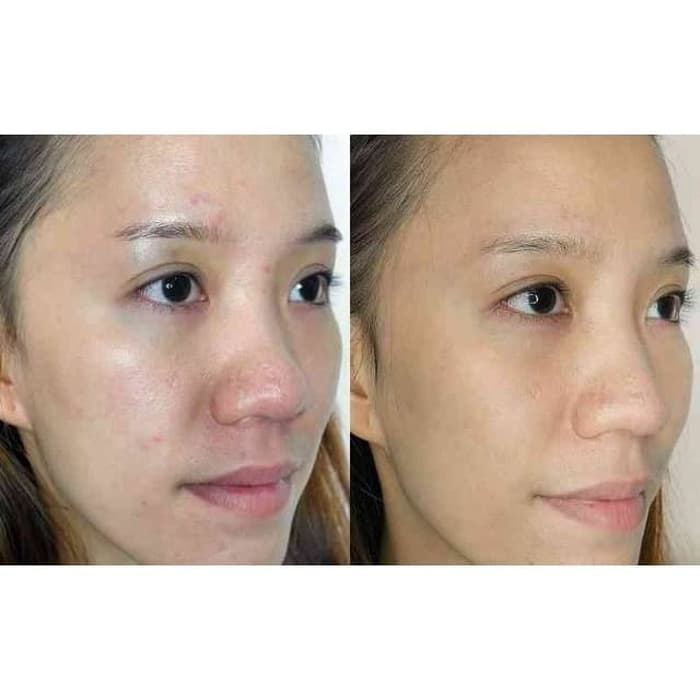 harga ponds age miracle intensive cell regen serum