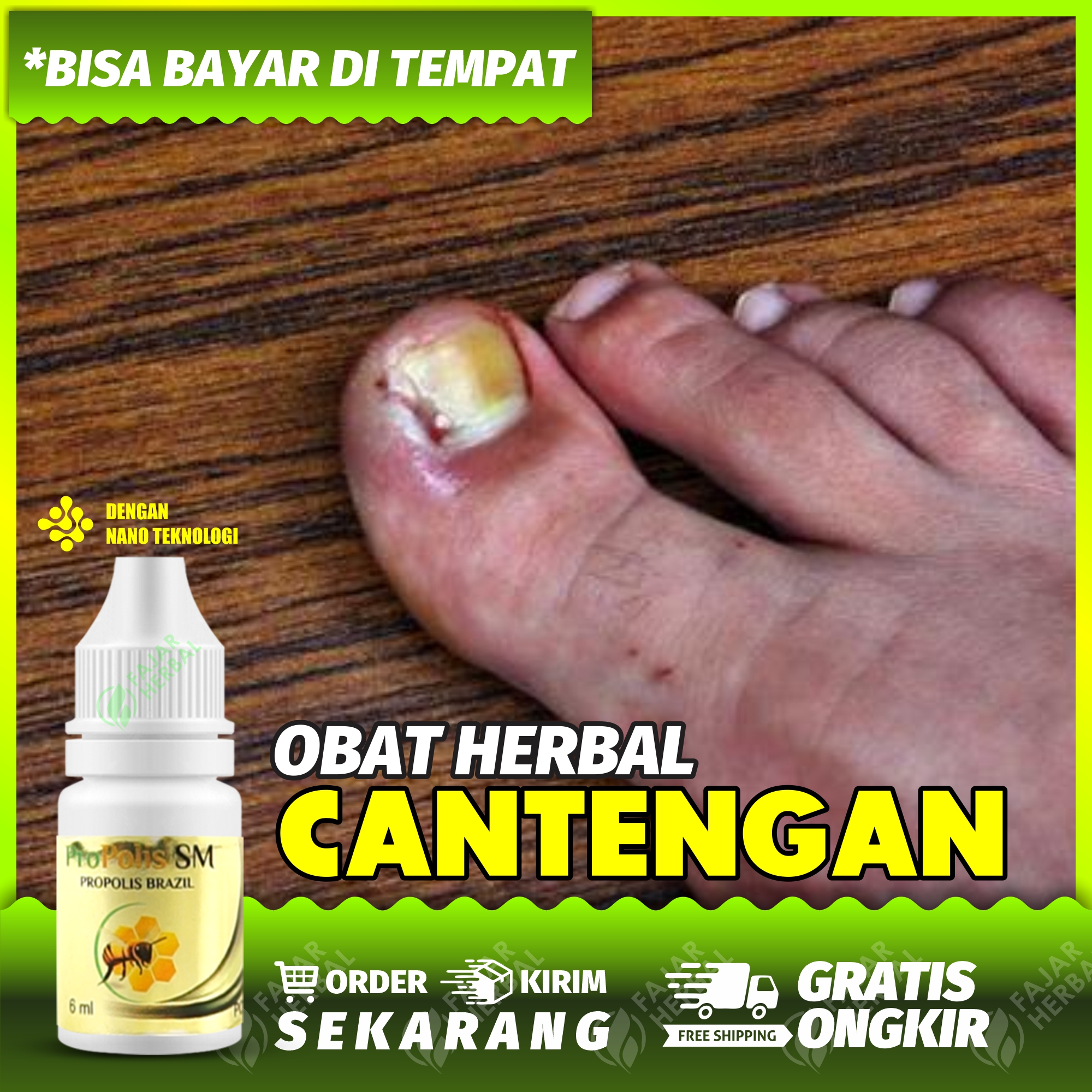 Obat Cantengan Bpom Dan Alami Obat Cantengan Jempol Kaki Murah Obat Cantengan Jari Tangan Obat Kekeongeun Obat Jempol Kaki Bengkak Bernanah Obat Paronikia Obat Kuku Jempol