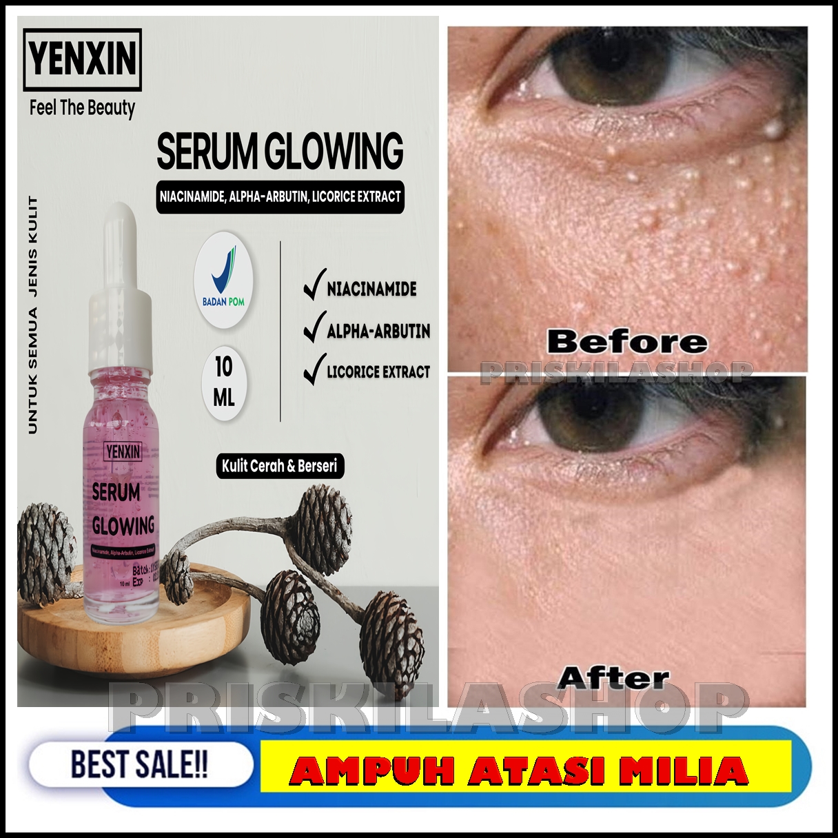 BISA COD SERUM KHUSUS MILIA Serum yang di formulasikan khusus untuk ...