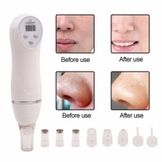 6 Tips Dermabrasion Peeling Machine Facial Skin Care MassagerBeauty Perangkat (Putih)-Intl