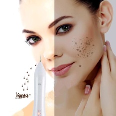 Laser Listrik Valve Anti Penuaan Pena Mole Kutil Bekas Luka Removal Mesin-Intl