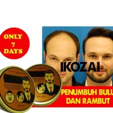 IKOZAI PENUMBUH BULU DAN RAMBUT IKOZAI JAMBANG JENGGOT MATA ALIS MINYAK WAK JEPANG DOYOK KEMIRI KAOS (REX-MART)