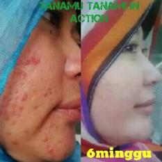 Minyak Tanamu Tanami Minyak Perawatan Kulit Termasuk Wajah