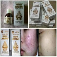 OBAT JERAWAT WAYANG - minyak oles