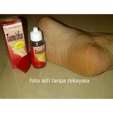 Tumitku Mengatasi Kaki Pecah- Pecah Kapalan dengan Instan BPOM -