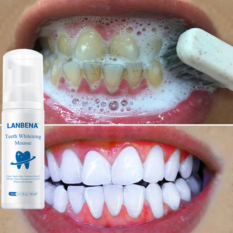 Lanbena Oral Care Teeth Whitening Mousse Pemutihan Gigi Mousse Pasta Gigi Kebersihan Mulut Menghapus Noda Plak Gigi Membersihkan Gigi Alat Putih Versi Baru 60ml Lazada Indonesia