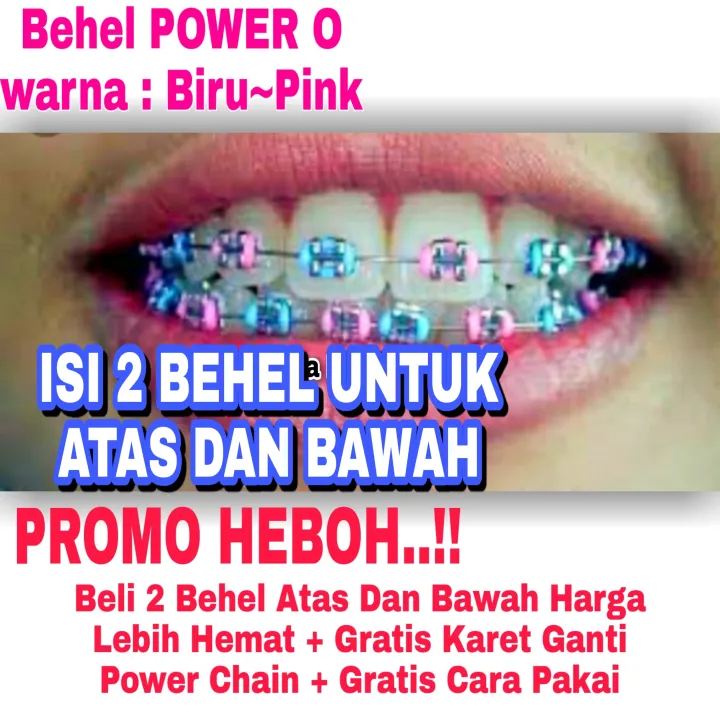 Termurah 2 Pcs Atas Dan Bawah Behel Fashion Lepas Pasang Warna Biru Pink Untuk Cewek Cowok Lazada Indonesia