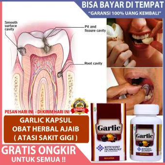 Obat Sakit Gigi Paling Ampuh Sakit Gigi Berlubang Meredakan Sakit Gigi Obat Sakit Gigi Obat Gusi