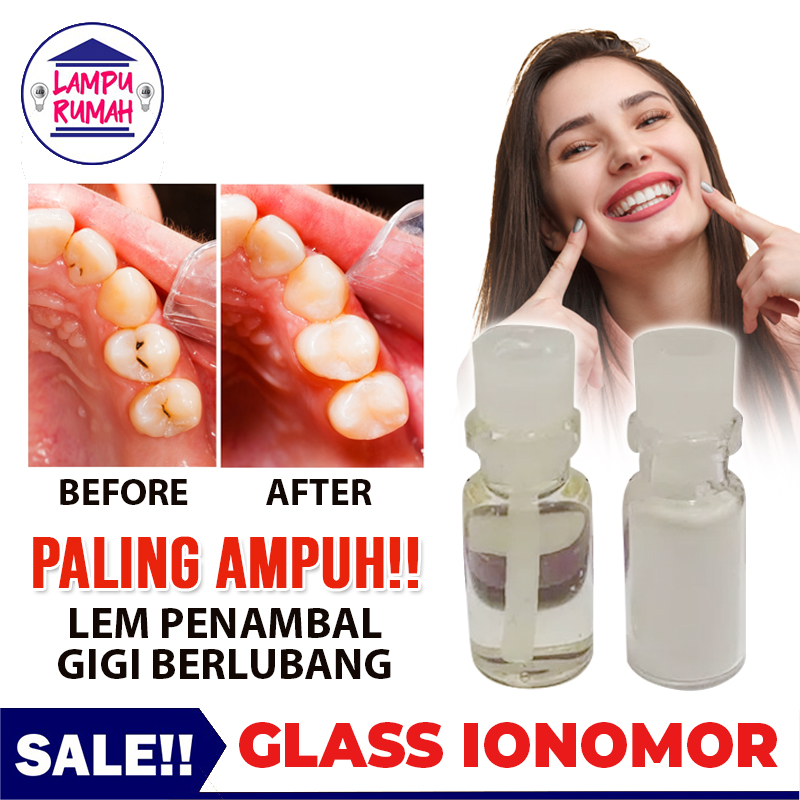 Glass Ionomer Cement Lem Behel Gigi GIC Glass Ionomer Cement GIC