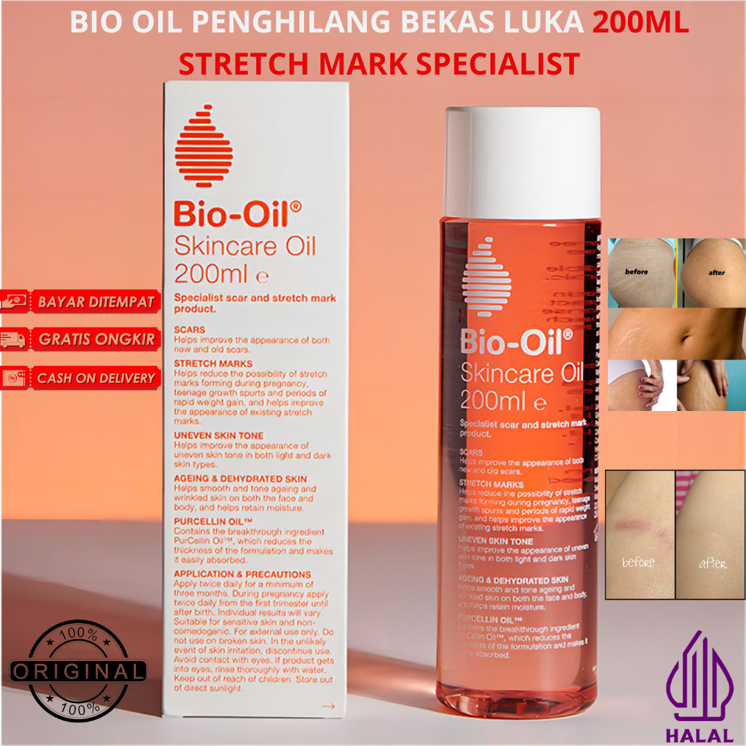 BIO OIL BEKAS LUKA 200ML Penghilang Bekas Luka Koreng Hitam Stretch