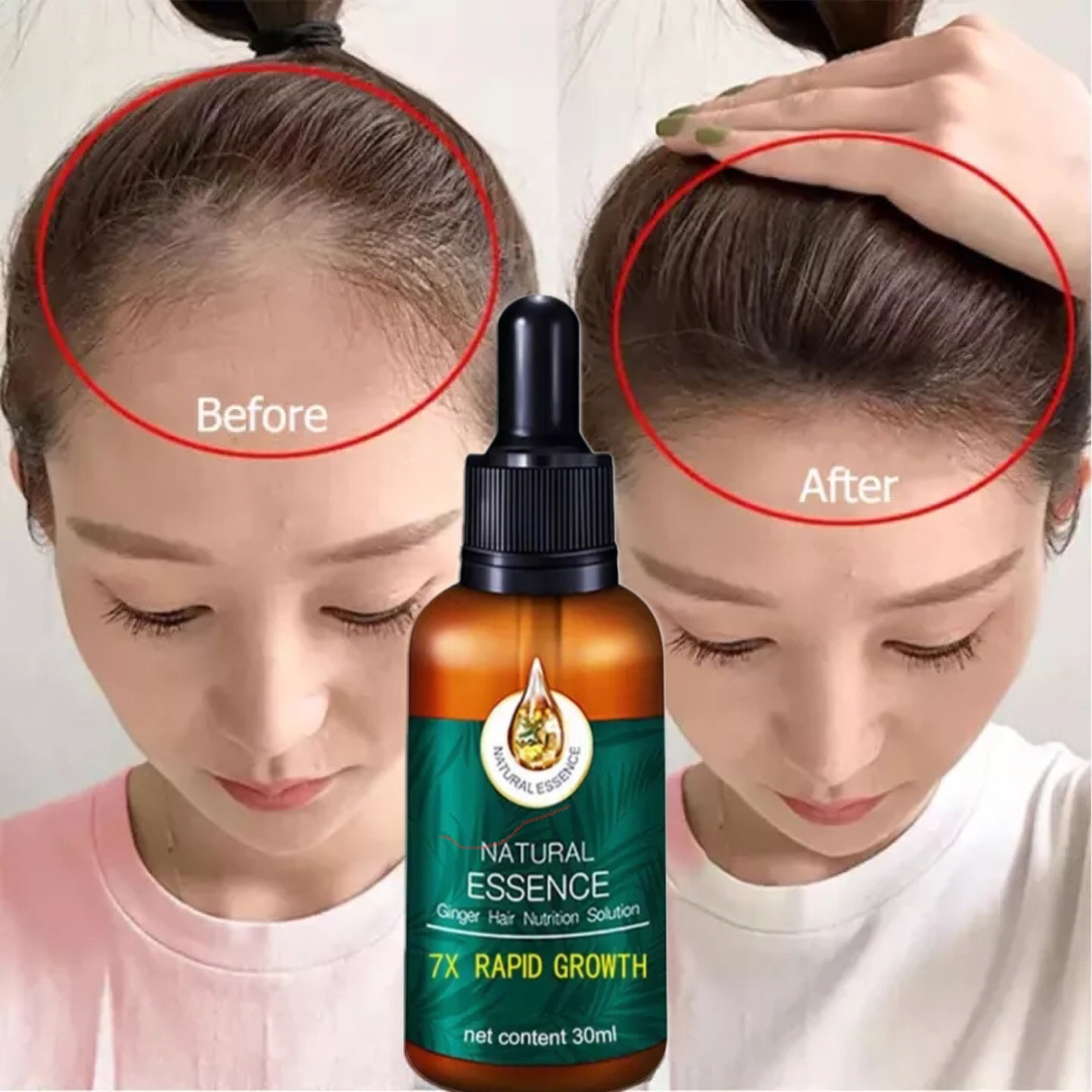 EELHOE Semprotan Penumbuh Rambut Hair Growth Serum Hair Growth Spray