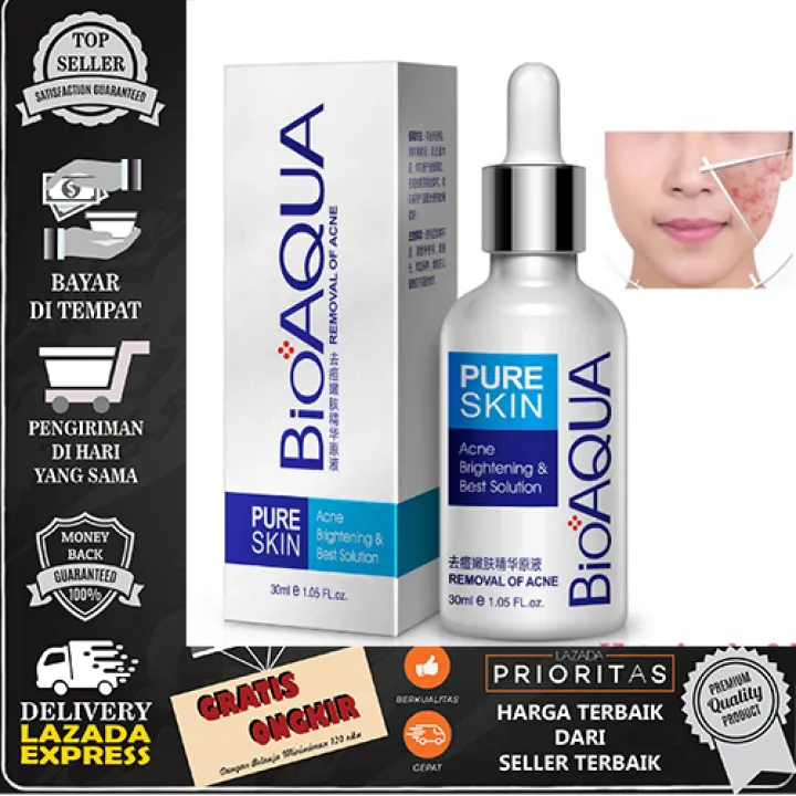 pure skin acne removal & brightening solution