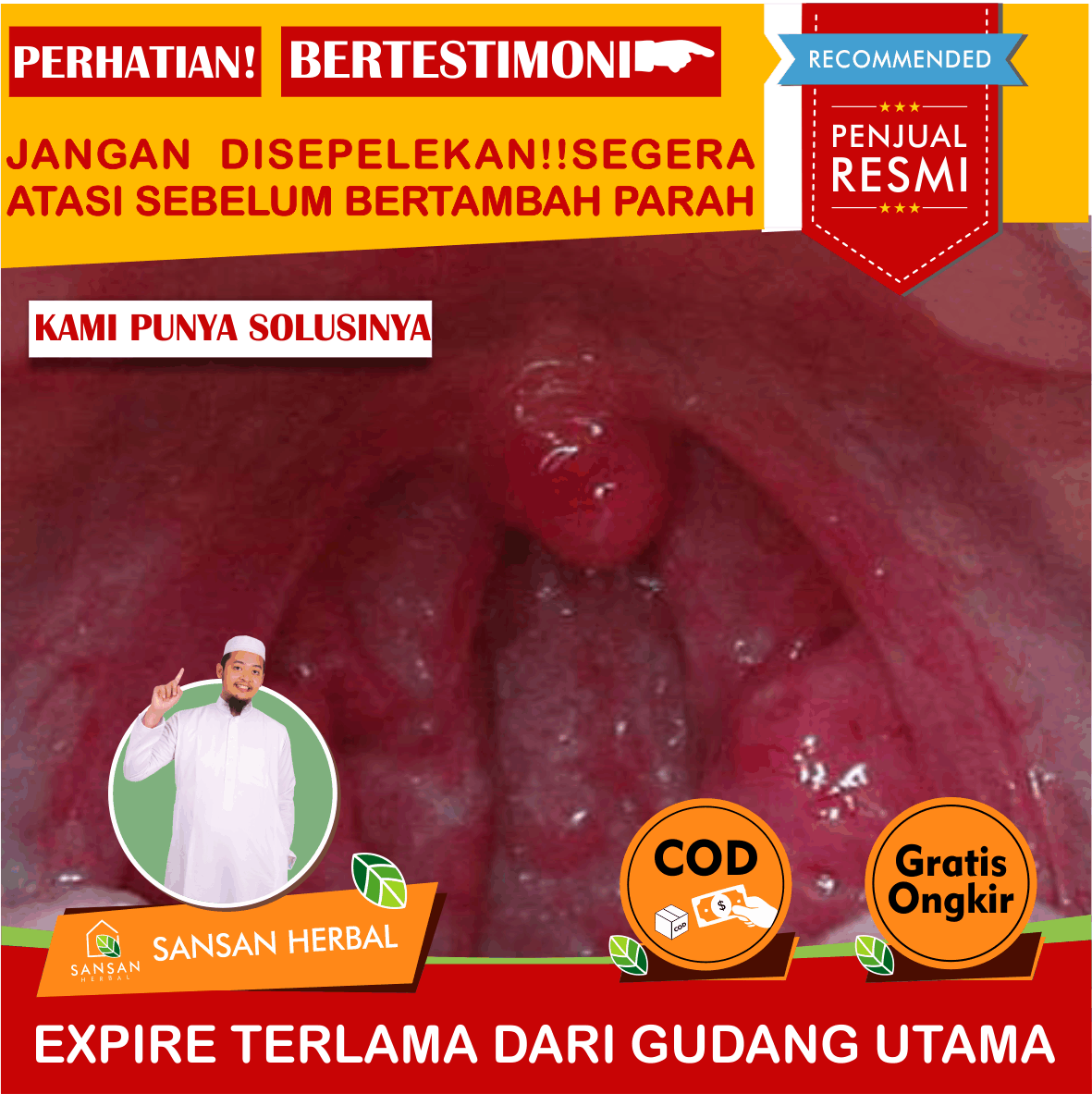 Obat Radang, Radang Tenggorokan, Radang Anak, Radang Sendi, Radang ...