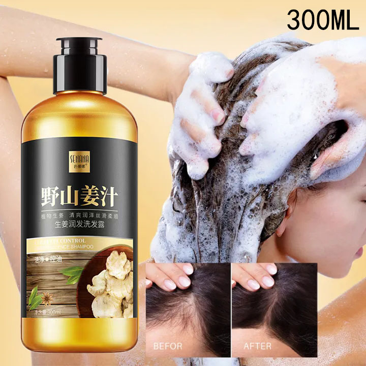 Shampo Penumbuh Rambut Cepat Anti Rambut Rontok Botak Ginger Shampoo 300ml Kontrol Minyak 4710