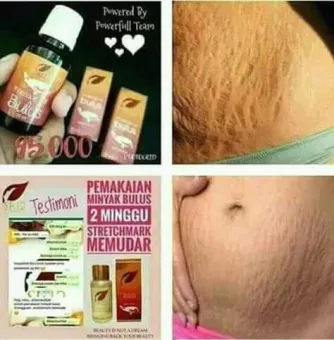 Obat Strechmark Minyak Bulus Pembesar Payudara Pembesar Mr P Obat Keloid Minyak Bulus Premium Minyak Bulus Kalimantan Penghilang Bekas Luka Lazada Indonesia