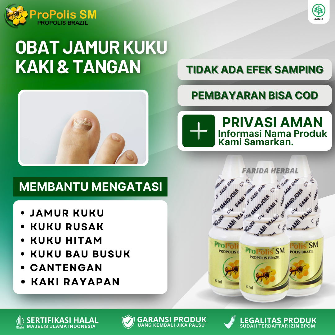 Obat Jamur Kuku Kaki Tangan, Kuku Rusak, Kuku Bau Busuk, Kuku Kaki ...