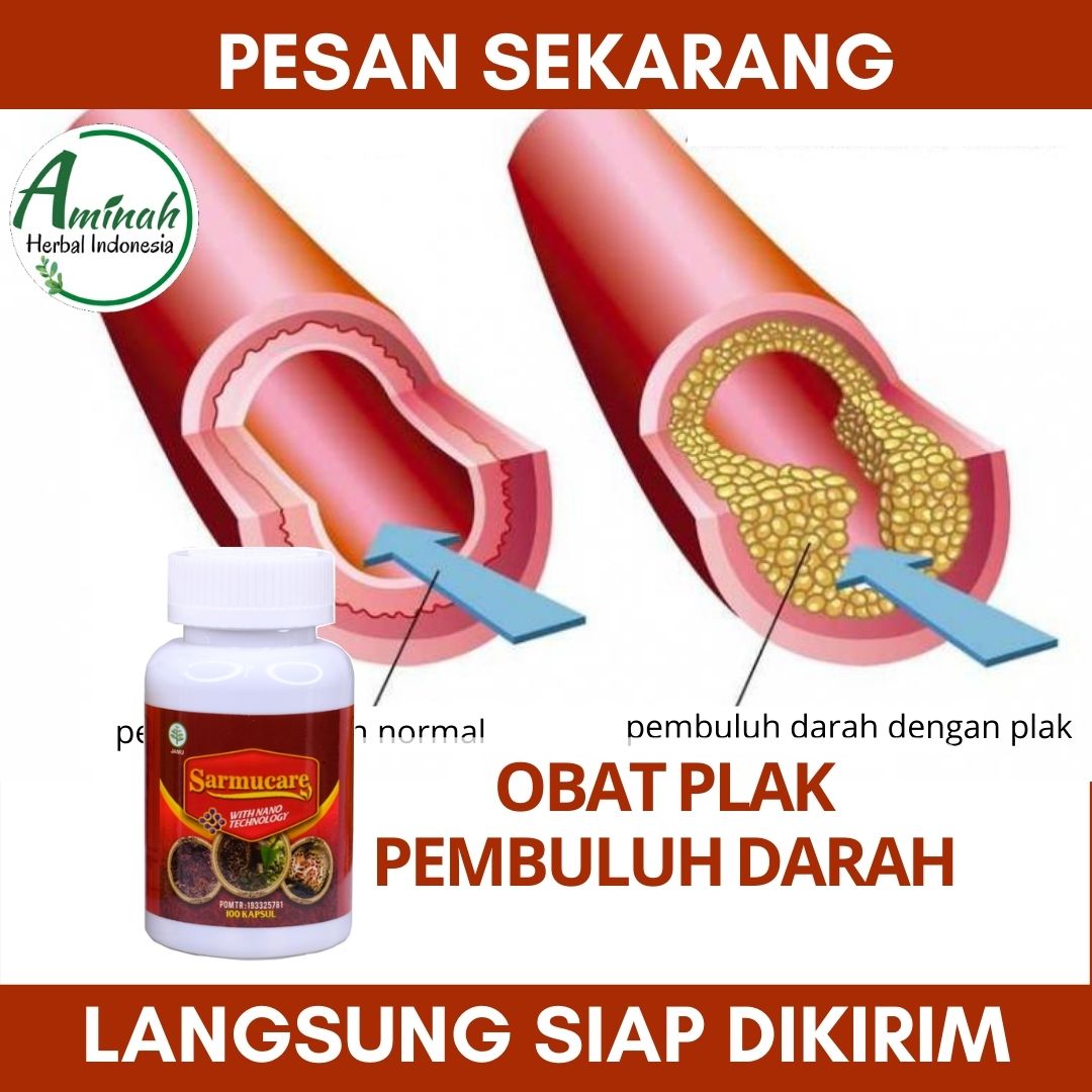 Obat Alami Penyempitan Pembuluh Darah Obat Penyumbatan Pembuluh Darah Obat Untuk Plak Di Pembuluh Darah Obat Peluruh Plak Di Pembuluh Darah Obat Untuk Menghancurkan Plak Di Pembuluh Darah Obat Herbal Pembersih