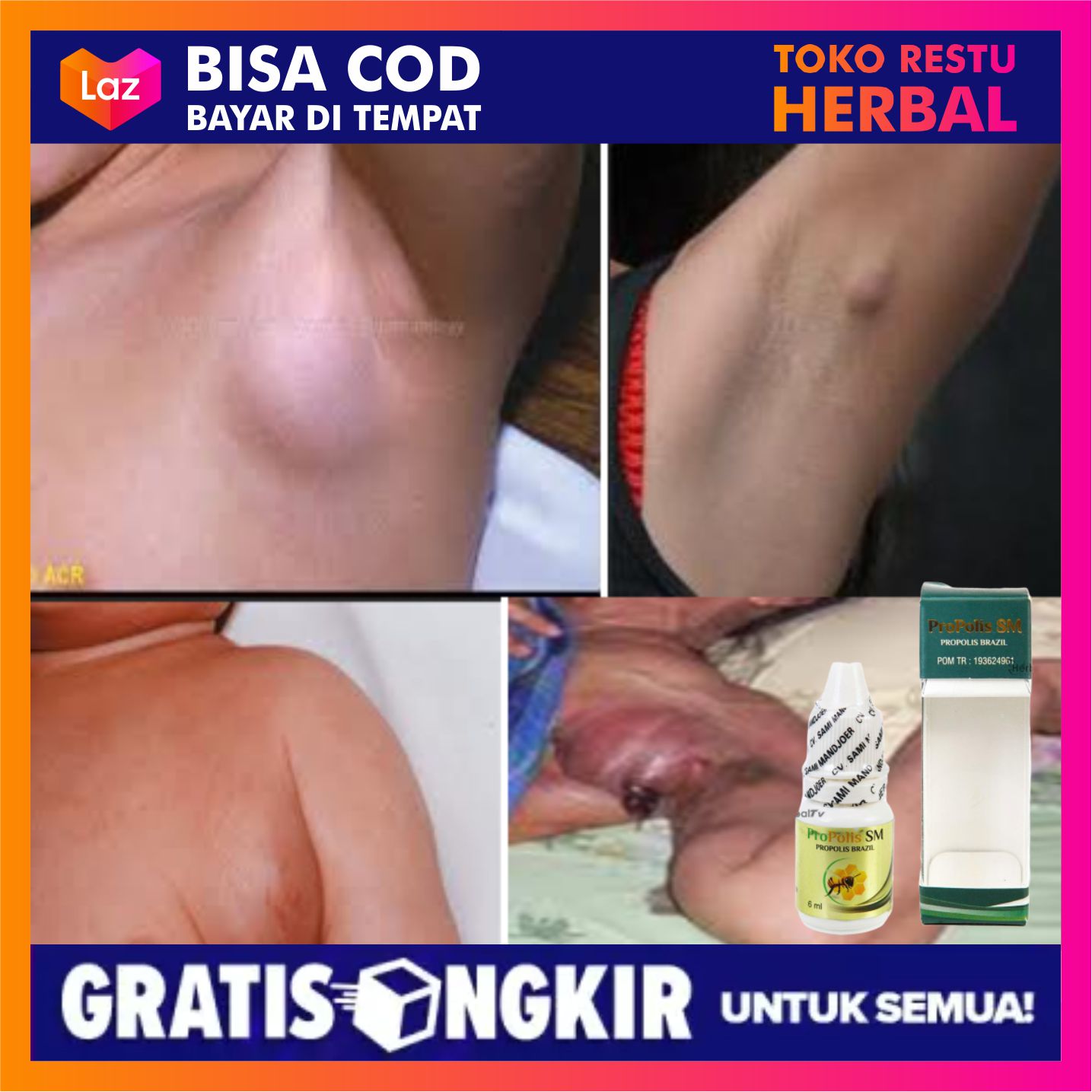 Obat Herbal Benjolan Di Ketiak Benjolan Di Ketiak Penghilang Benjolan Di Ketiak Obat Benjolan Di Ketiak Obat Untuk Benjolan Di Ketiak Obat Penghilang Benjolan Di Ketiak Bukan Salep Benjolan Di Ketiak Propolis