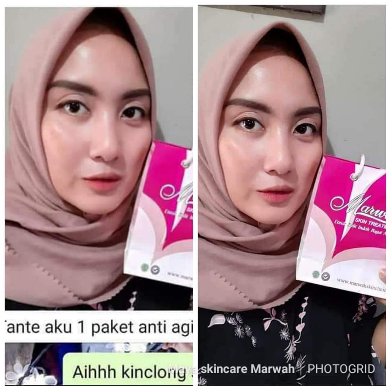 Cream Siang Malam Marwah Skin Care Aging Spcial Cream Pencerah Wajah Alam Cream Penghilang Noda Hitam Membandel Cream Wajah Bpom Crem Penghilang Flek Hitam Membandel Lazada Indonesia Cream Siang Malam Marwah Skin Care Aging Spcial Cream Pencerah Wajah Alam Cream Penghilang Noda Hitam Membandel Cream Wajah Bpom Crem Penghilang Flek Hitam Membandel Lazada Indonesia