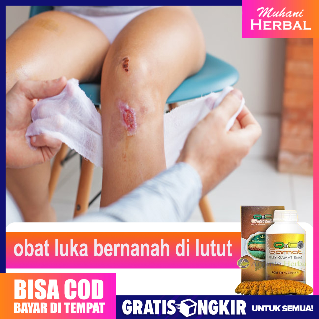 Obat Luka Bernanah Di Lutut - Qnc Jelly Gamat | Lazada Indonesia
