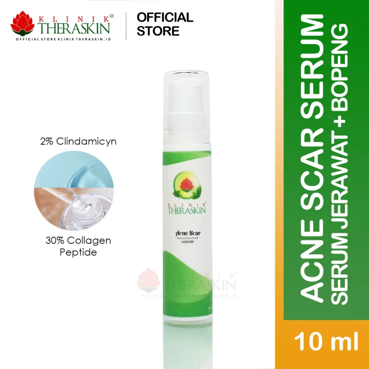 serum untuk acne scar