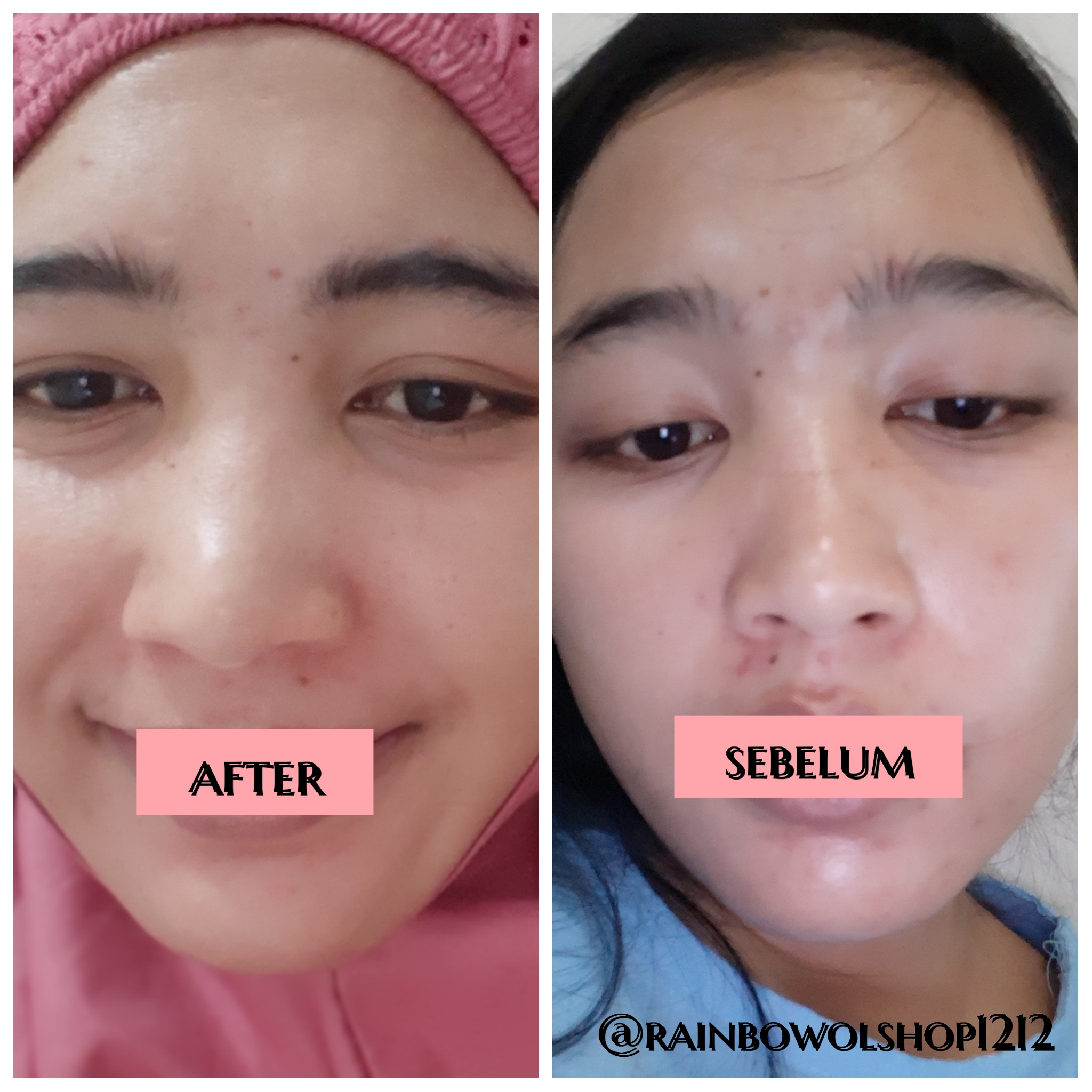 breylee pore minimizer serum step 2