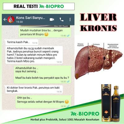 M BIOPRO Obat Liver Kronis, Ringan Suplemen Kesehatan > Obat-obatan Tradisional Hepatitis A B Dan C Hbsag, Penyakit Kuning, Kanker,Pembengkakan Hati,Gagal Ulu Hati,Radang Bengkak Hati,Hemangioma,Sirosis Hati,Autis,Fungsi Hati Lemah,Limpa,Herbal Mbiopro