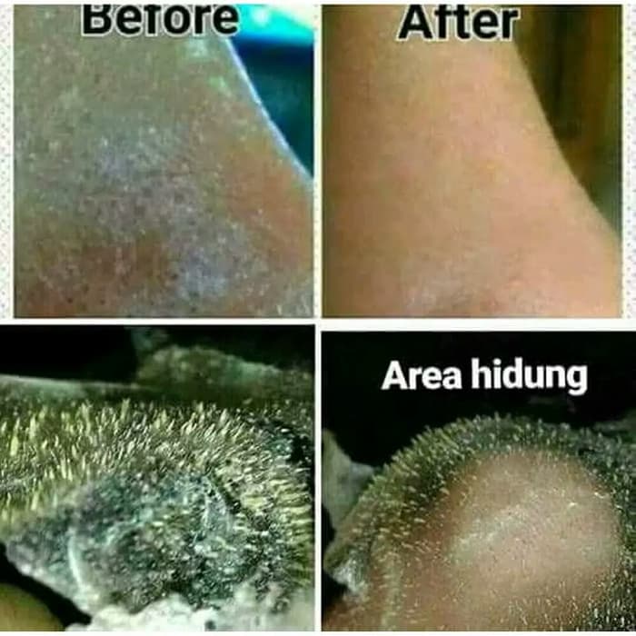 Bayar Di Tempat Masker Komedo Gelatin Sapi Halal Isi 5 Gram Lazada Indonesia