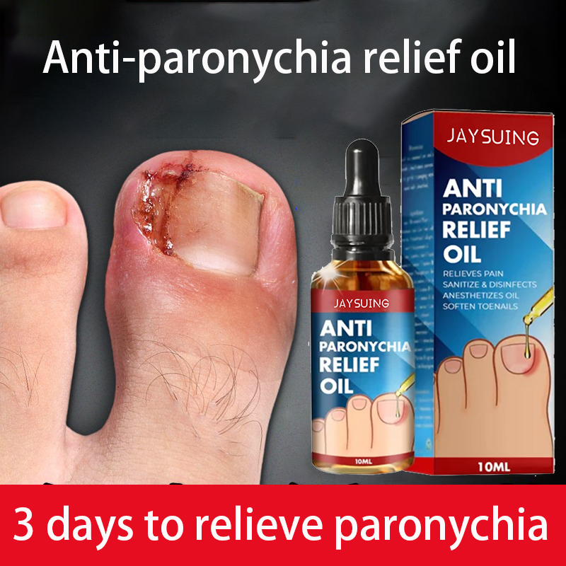 Minyak bantuan anti-paronikia Removal Paronychia Oil Nail Fungus ...