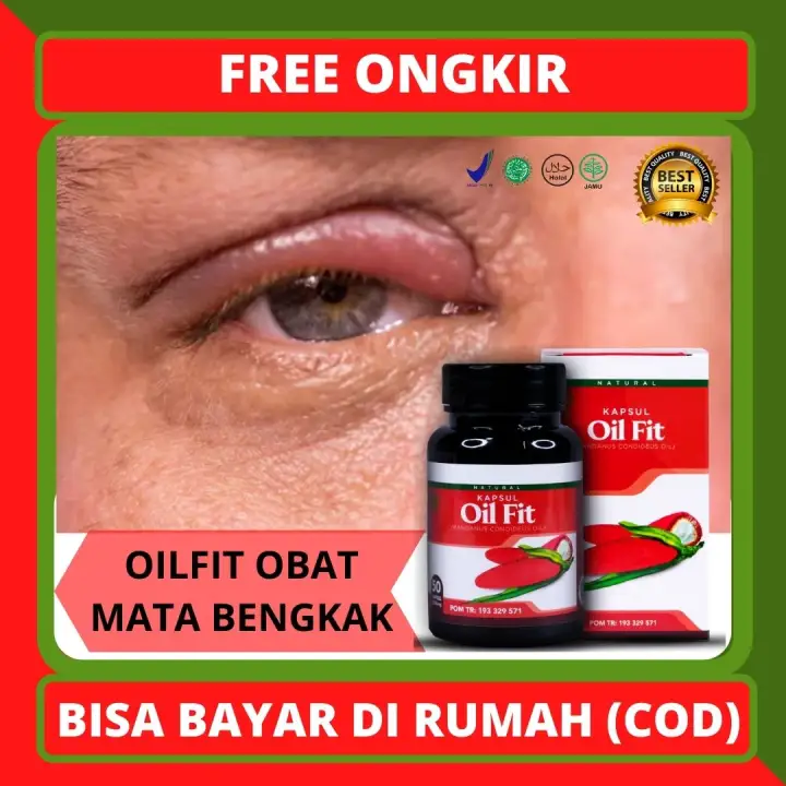 Ubat Sakit Mata Bengkak
