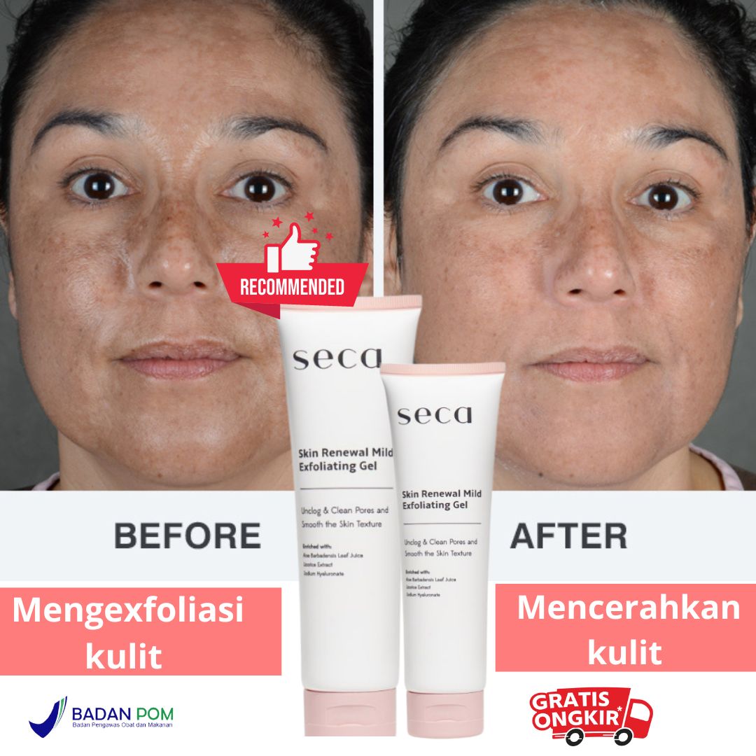 Seca Skin Renewal Mild Exfoliating Peeling Gel 30gr BPOM Lazada Indonesia