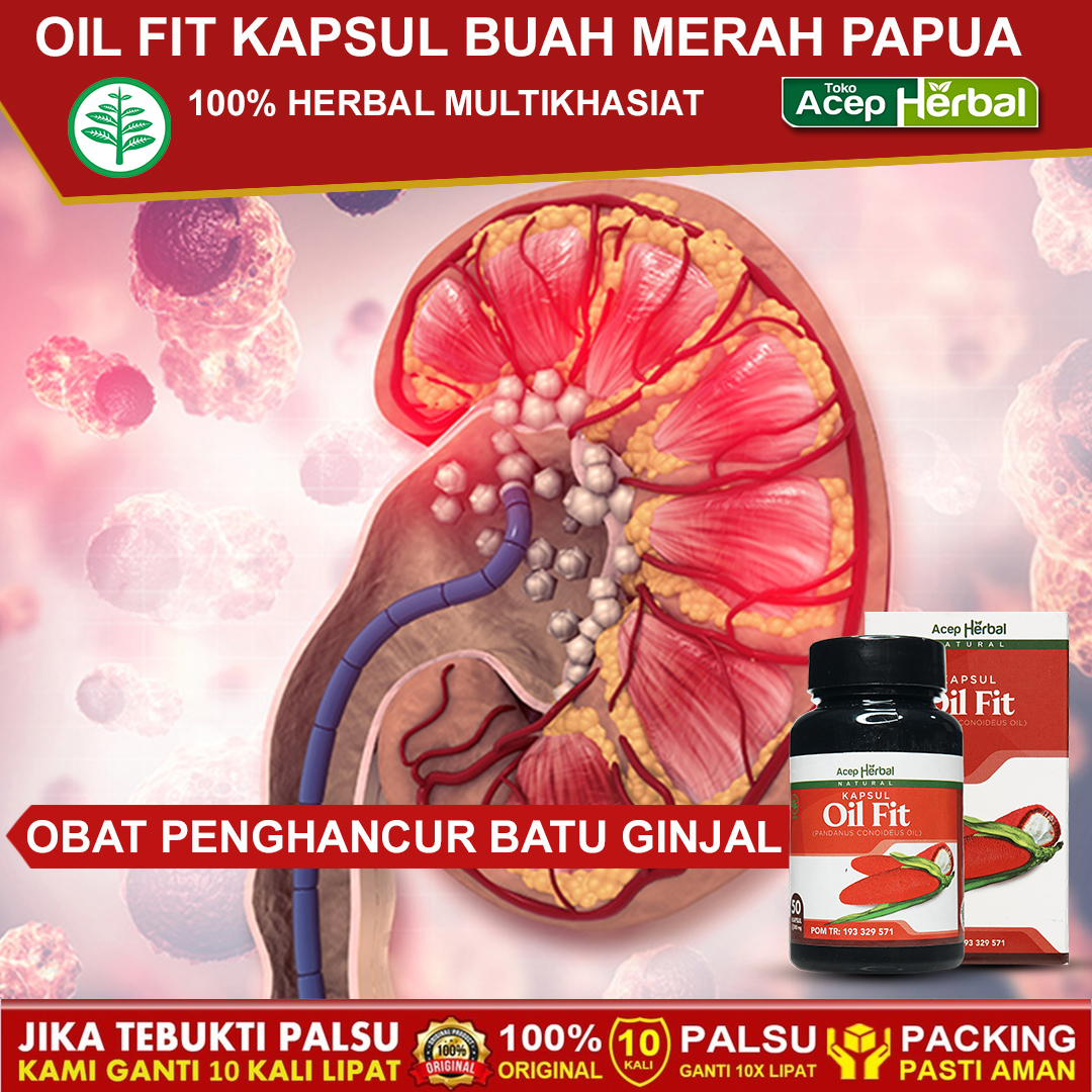 Oil Fit Obat Batu Ginjal Penghancur Batu Ginjal Bengkak Obat Ginjal