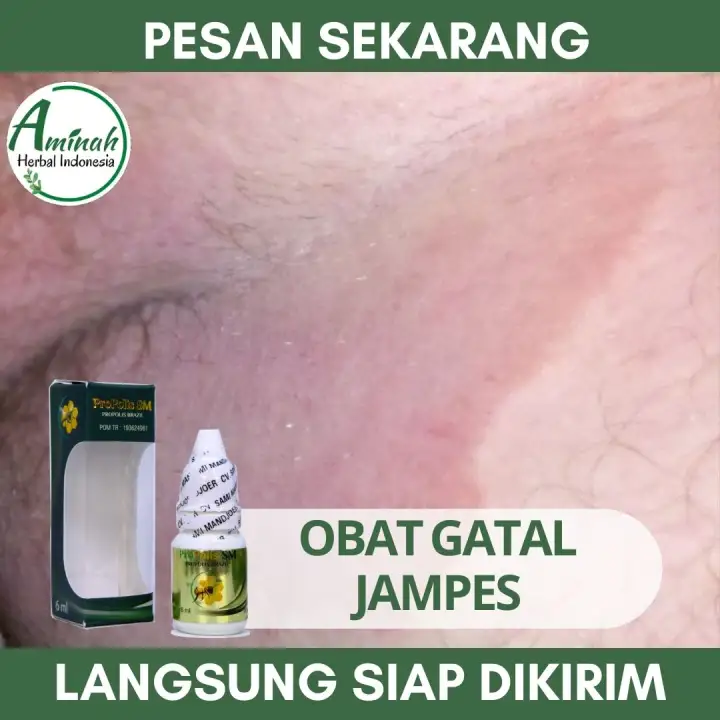 Griseofulvin Fungsi Dosis Efek Samping Dll Hello Sehat