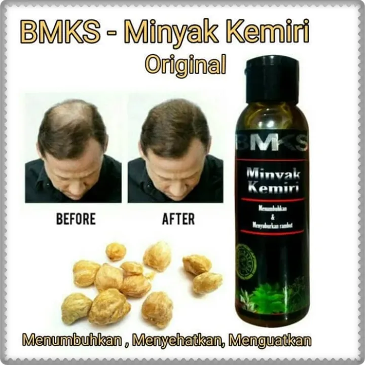 Green Angelica Penumbuh Rambut Penumbuh Rambut Cepat Panjang Bmks Minyak Kemiri Penyubur Penumbuh Dan Penghitam Rambut