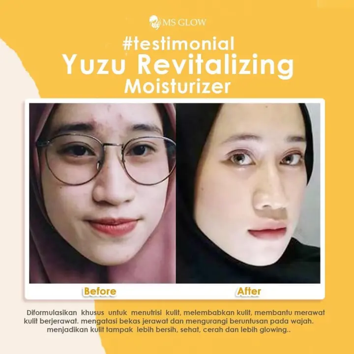 harga yuzu revitalizing juice ms glow