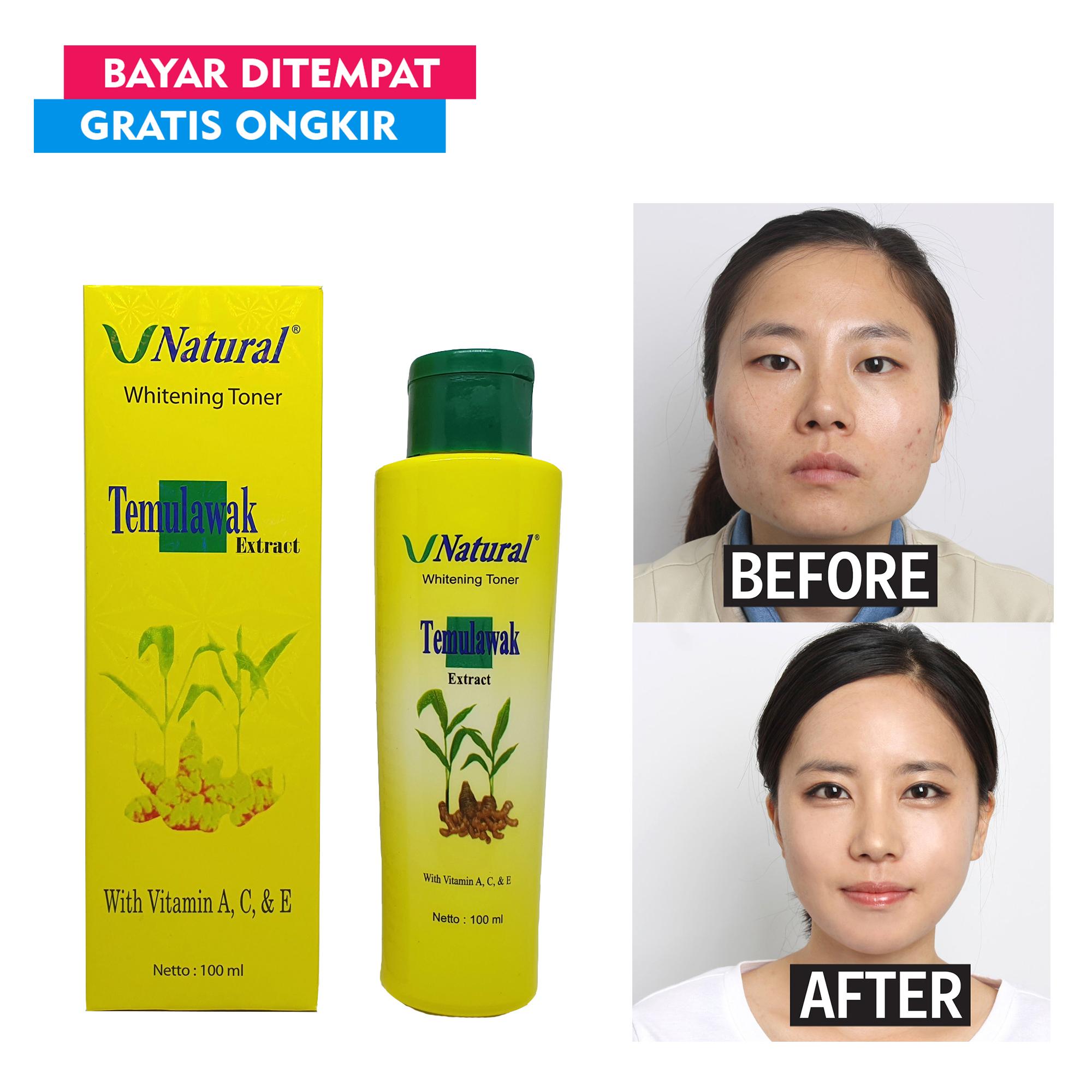 V Natural Whitening Toner Temulawak Original Bpom Original Lazada Indonesia