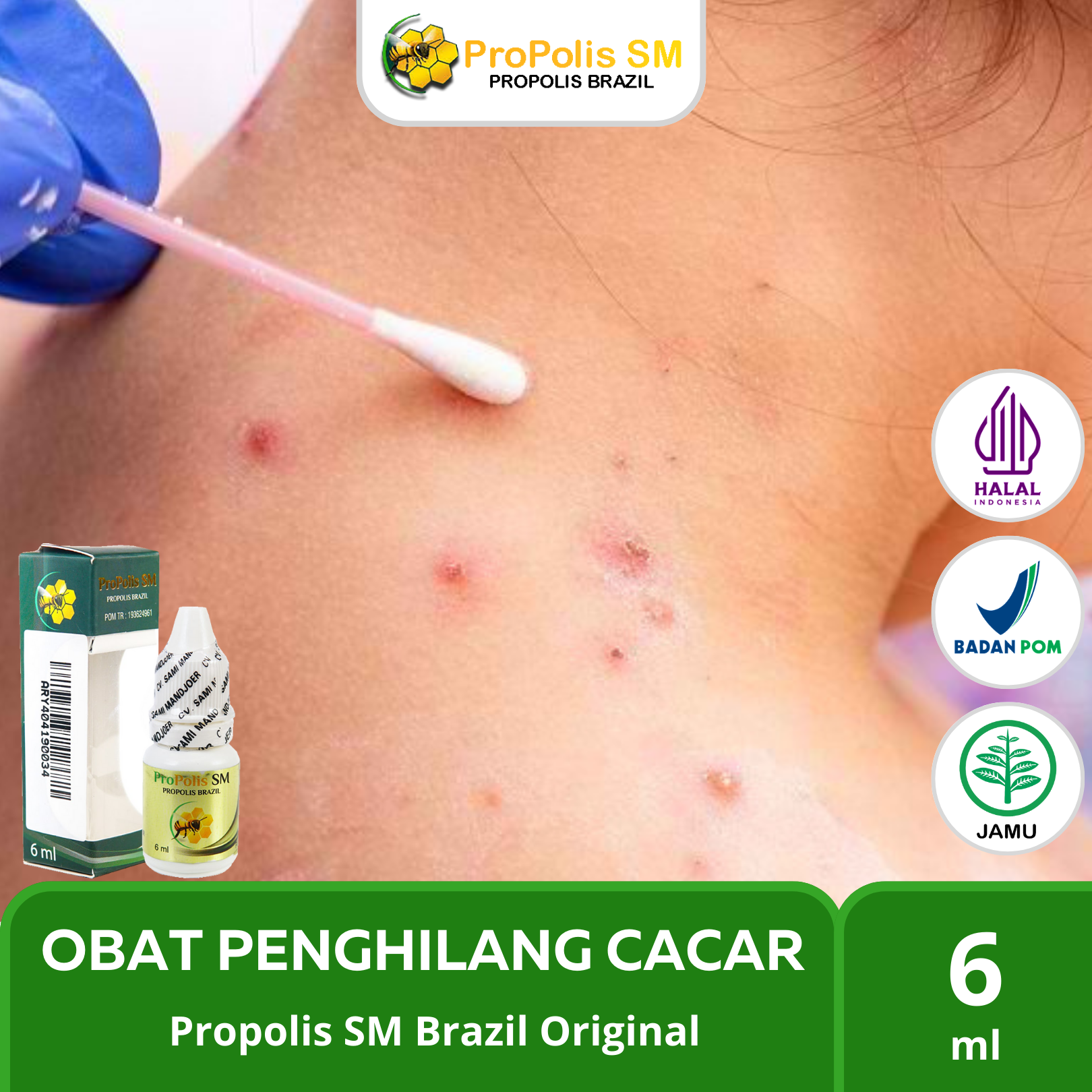 Propolis Asli Original - Obat Cacar Anak Dan Dewasa Obat Cacar Air Obat ...