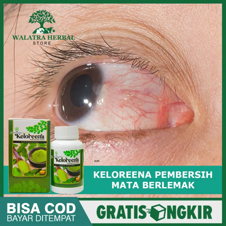 Obat Herbal Mata Berlemak Solusi Untuk Pterygium Mata Mata Berkabut Mata Berselaput Pembersih Pencerah Mata Keloreena 100 Ekstrak Daun Kelor Original Lazada Indonesia