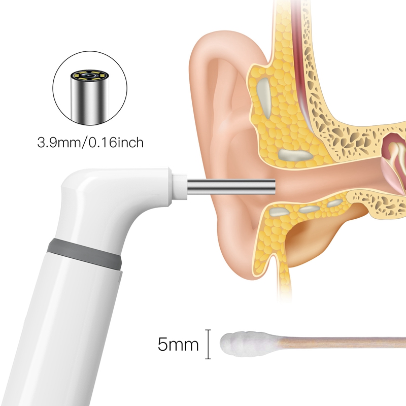 5 in 1 Wifi Endoscope 1MP 1080P HD Visual Ear Spoon Earpick 3.9mm Dual Camera Lens Android PC Ear Otoscope for Android PC IOS