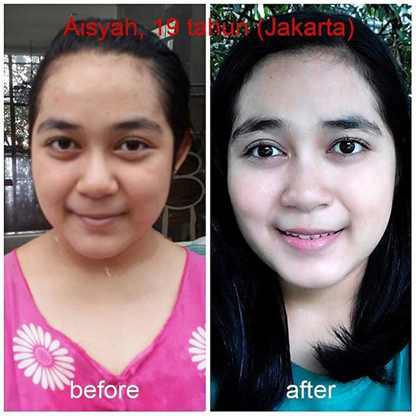 testimoni sunscreen emina